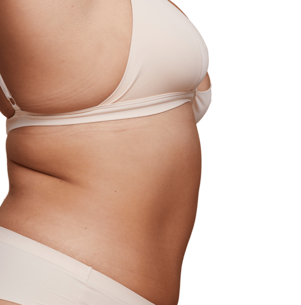 Plastic Surgery And Associates Tummy Tuck 3